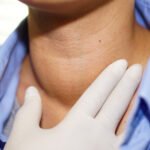 Hypothyroidism