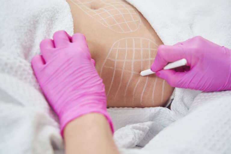 Unrecognized client during the process reduction of abdominal fat